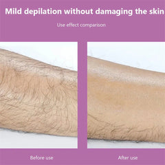 Crystal Hair Eraser - Magic Crystal Hair Remover, Painless Hair Removal With Epilator Mini Hair Remover For Men And Women Leg Arm Back Soft Smooth Silky Skin