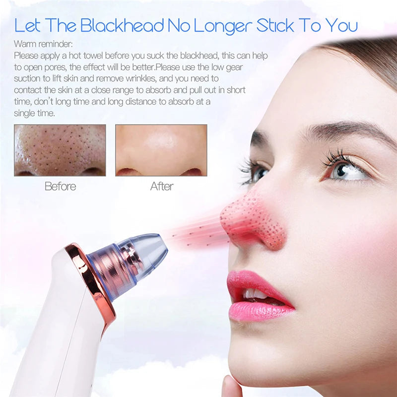 Derma suction Blackhead Remover Vacuum Acne Cleaner Black Spots Removal